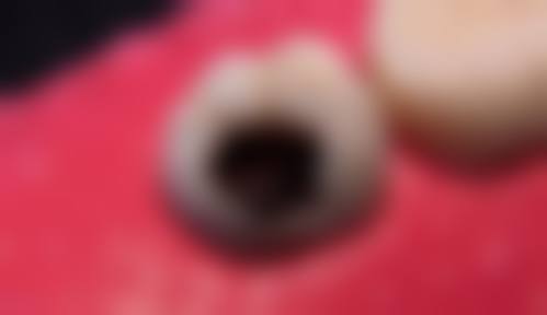 广东中山爱牙士口腔地址及到院路线