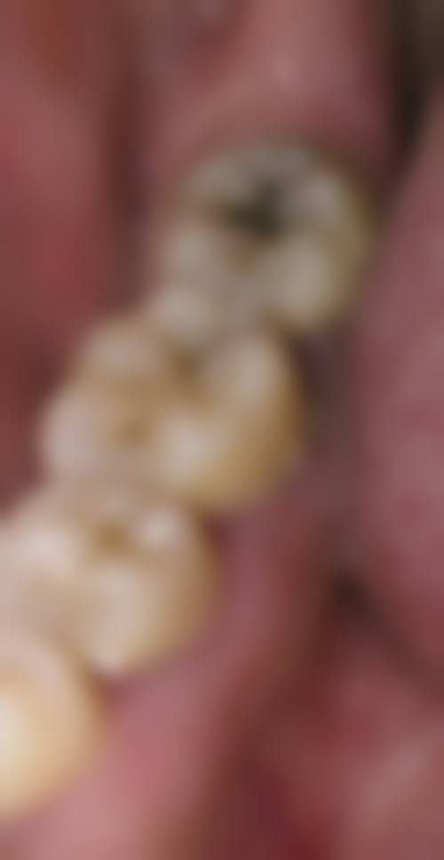 滨州邹平方利口腔2026价格表参考