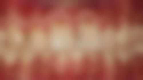 千喜口腔·矫正种植中 心(布吉店)医生团队解析