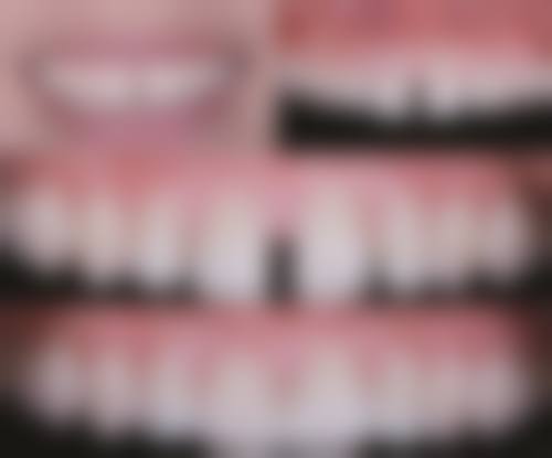 西安宏康口腔口碑评价