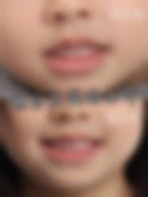 深圳利齿口腔交通攻略