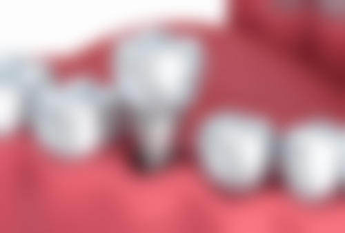 云南丽江宁蒗紫玛口腔擅长项目有哪些？