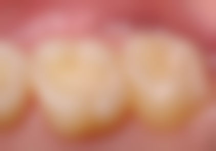 徐垲垒擅长项目列表