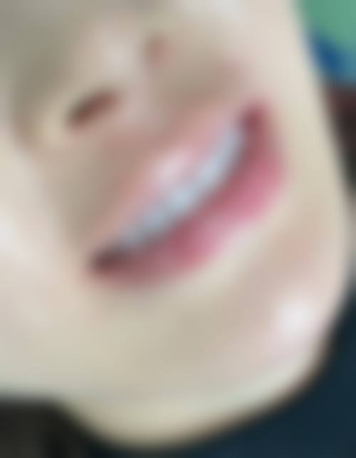 余艳擅长项目列表