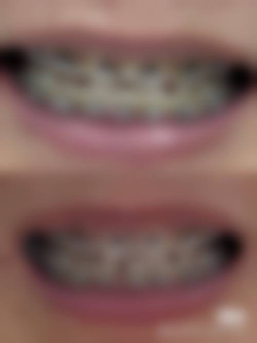 安徽阜阳精瓷口腔口碑评价