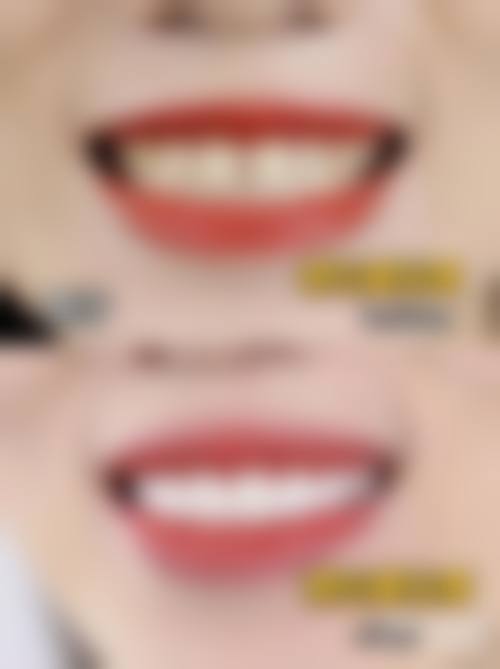 大连博利德口腔诊所技术设备怎么样？