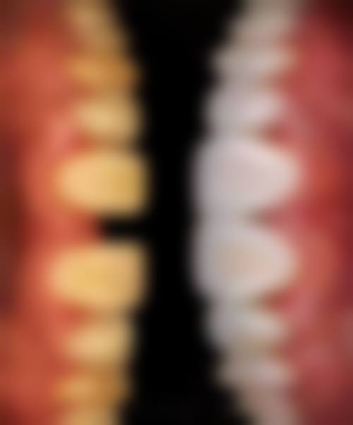 安徽阜阳精瓷口腔2026价格表参考