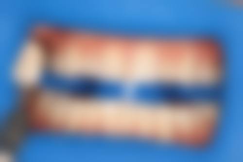 重庆荣昌杨晓红口腔诊所医生团队解析