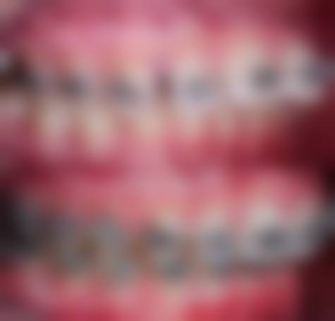 南宁雅鑫口腔诊所口碑评价