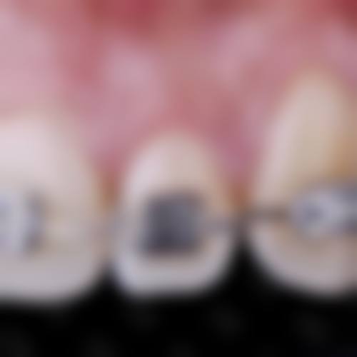 南宁雅鑫口腔诊所擅长项目有哪些？