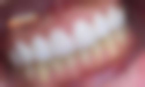 杭州华 山连天美医疗美容口腔科医生团队解析