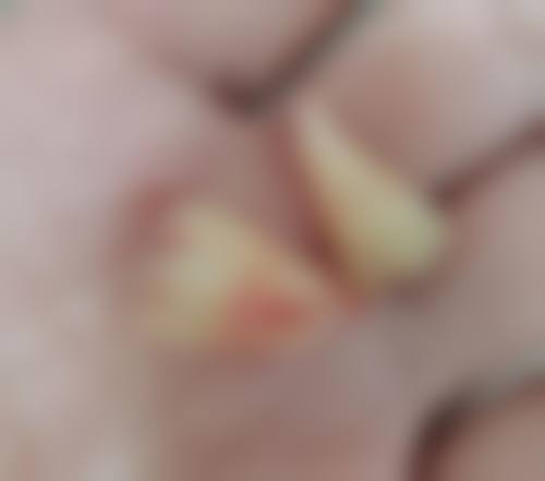 德州陵城小雅口腔口碑评价