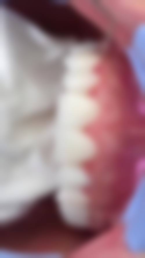 广东珠海瑞齿口腔诊所2026价格表参考