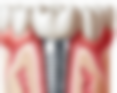 广西桂林卓越口腔医生团队解析