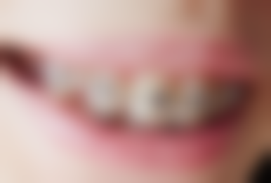 郭战月擅长项目列表