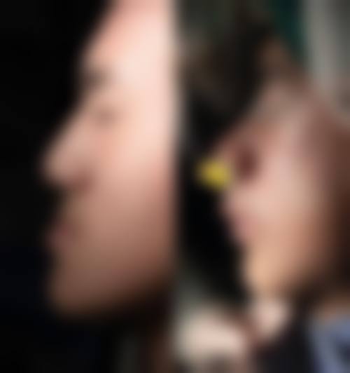 天津雅尔口腔(西湖道店)医生团队解析