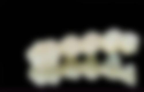 廊坊固安京诚康口腔门诊2026价格表参考