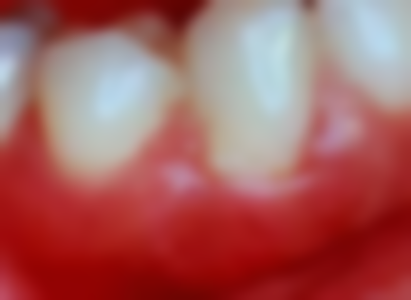 武汉大学口腔医院口腔黏膜科医生团队解析