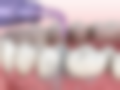 武汉大学口腔医院口腔黏膜科口碑评价