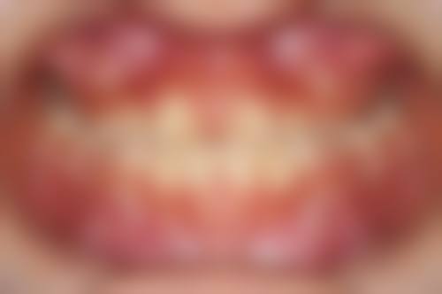 十堰茅箭区五堰从兵口腔地址及到院路线