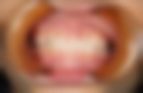 淄川阚建国口腔擅长项目有哪些？