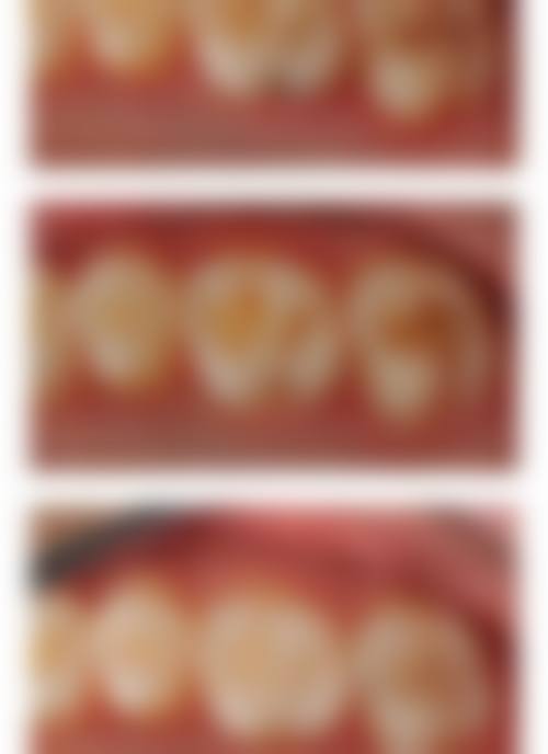 泰安春光口腔2026价格表参考