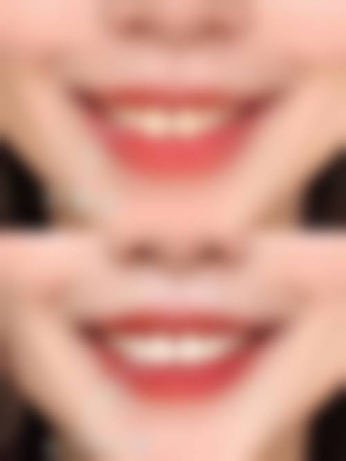 泰安春光口腔技术设备怎么样？