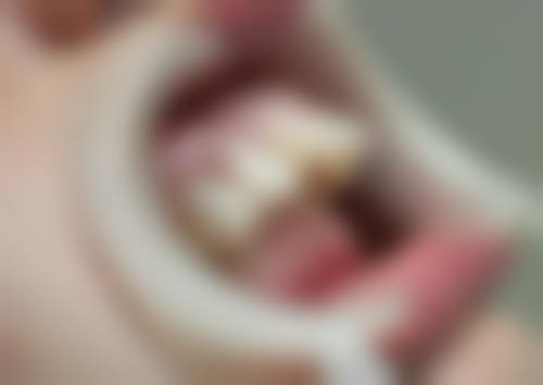 刘凯强预约方式及价格表