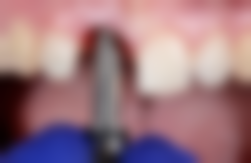 武汉爱齿尔口腔(硚口院)擅长项目有哪些？