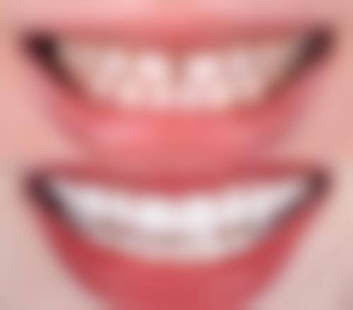 广东广州万博口腔擅长项目有哪些？