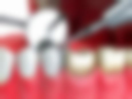 江苏徐州睢宁牙卫士口腔交通攻略