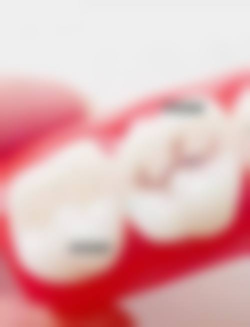 内蒙古自治区中医医院口腔科擅长项目有哪些？