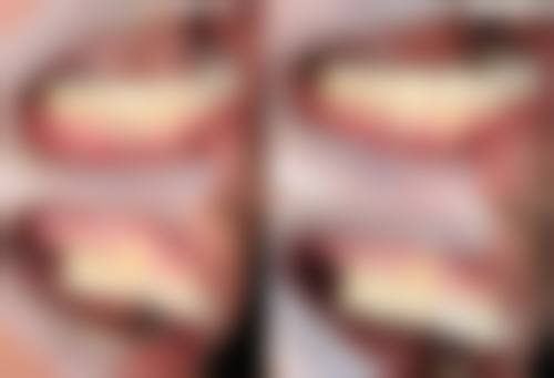 江苏南京金城丽景口腔科医生团队解析