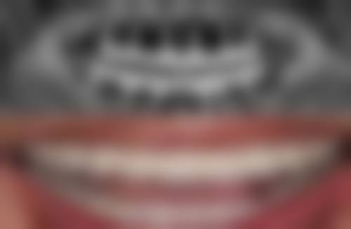 付灿文擅长项目列表