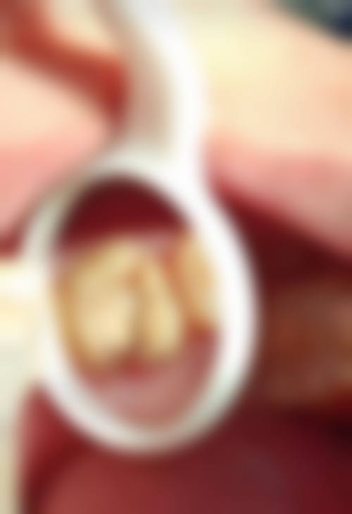 广东深圳艾牙口腔诊所2026价格表参考