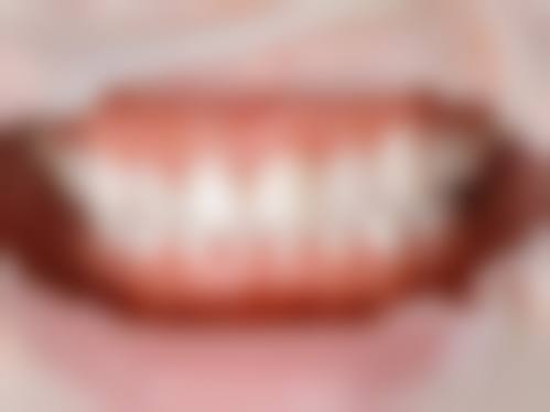 徐州新健康医院口腔科技术设备怎么样？