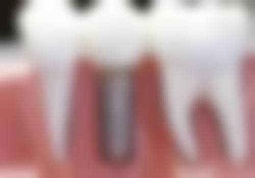 浙江金华婺城口腔医院口碑评价