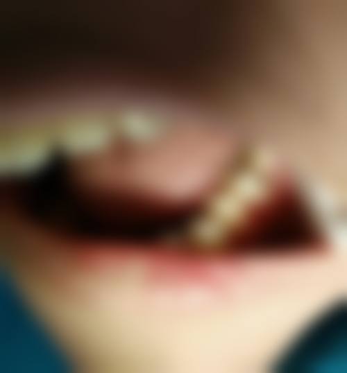 简阳牙米口腔交通路线