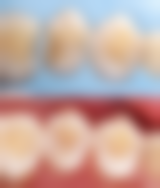 商洛东鹏口腔擅长项目有哪些？