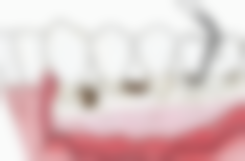 武汉清华阳光口腔(汉阳总院)地址及到院路线