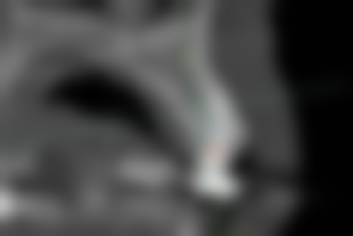 广西 南宁恺泽恺贝口腔擅长项目有哪些？