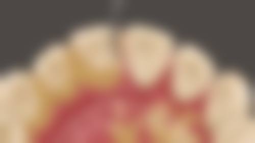 肥西新安口腔门诊部口碑评价