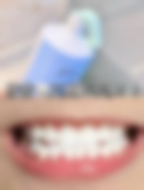 北京顺义喜善口腔门诊擅长项目有哪些？