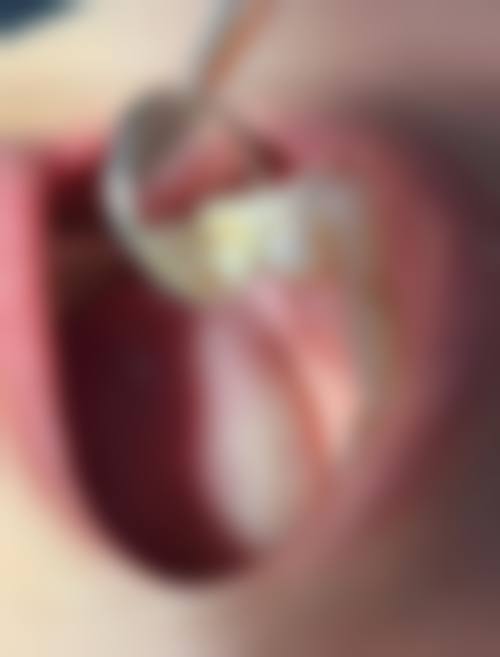 天津雅生口腔擅长项目有哪些？