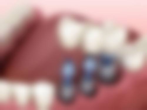 菏泽周涛口腔诊所2026价格表参考