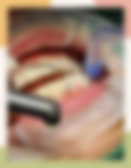 鹿泉赵丽口腔擅长项目有哪些？