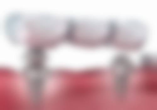 浙江金华义乌益齿口腔门诊部擅长项目有哪些？