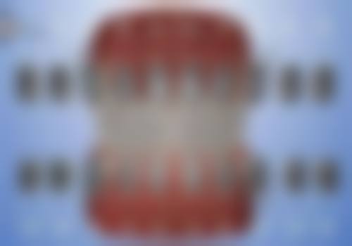 新郑一口好牙口腔口碑评价