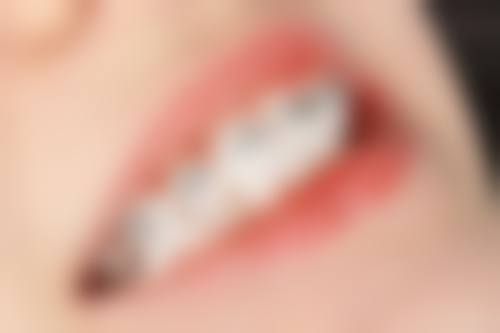 西安百臻美口腔口碑评价