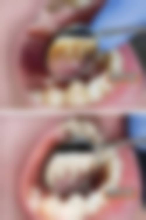 【江苏淮安金湖微信口腔真实口碑评价】